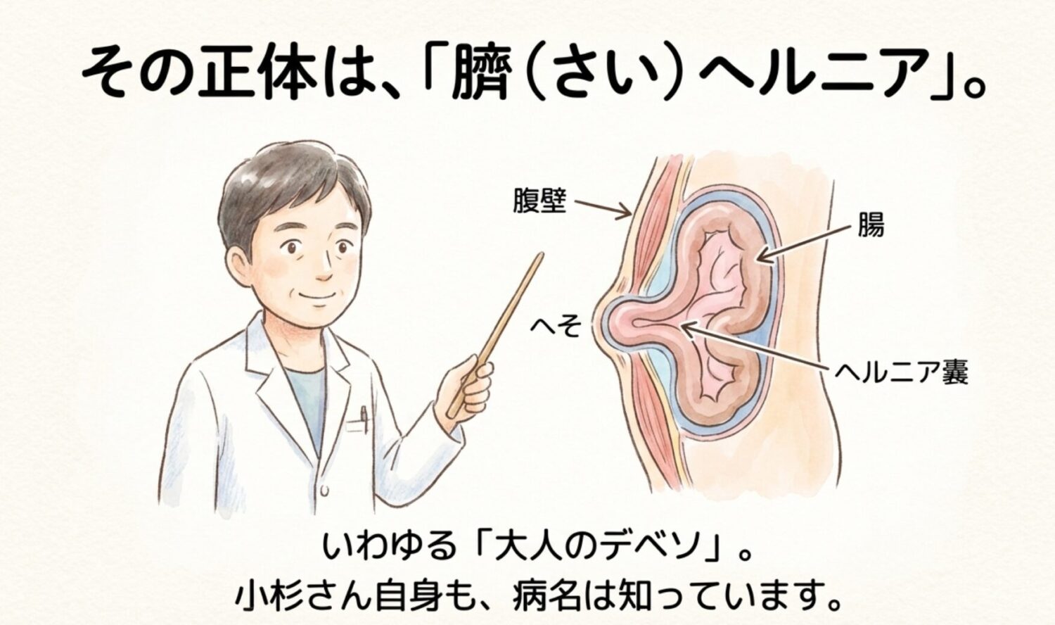 正体は「臍ヘルニア」。簡単に言うと「大人の出べそ」