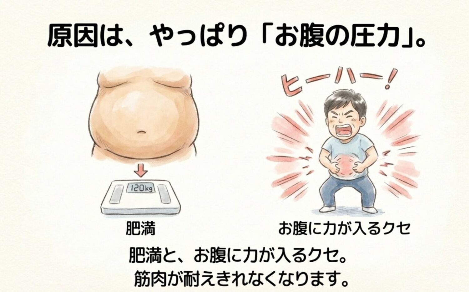 なぜ臍ヘルニアに? 原因はやっぱり肥満?