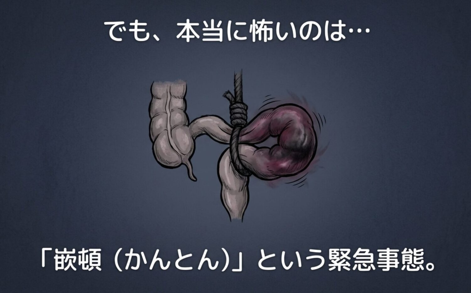 放置するとヤバい? 「嵌頓(かんとん)」